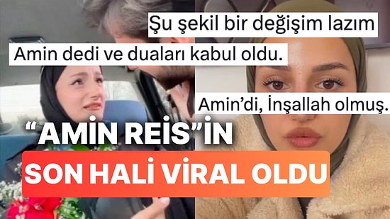 Tüm Ülkeye "Amin" Dedirten TikTok Fenomeni Gizem Yıldız'ın Estetik Sonrası Hali "Duası Kabul Oldu" Dedirtti