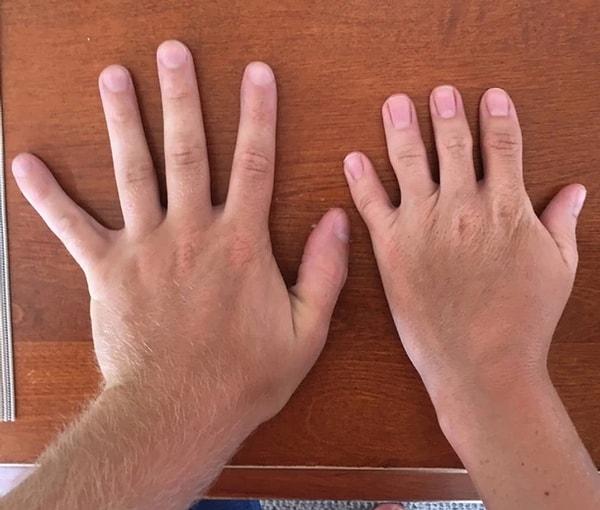 13. "Kız kardeşimin tüm parmaklarında bir boğum eksik. Bunlar sol ellerimiz."
