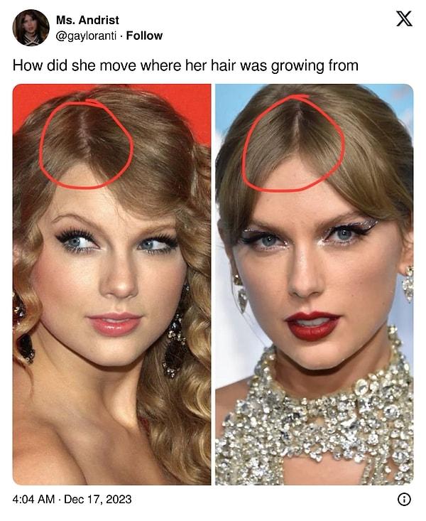 Fakat herkes o zamanları aşabilmiş değil. Bir Twitter kullanıcısı Taylor Swift'in saç çizgisinin "gizemli" bir biçimde nasıl değiştiğini sorgulayınca yine o günlere ışınlandık.