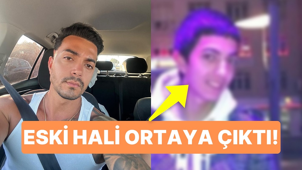 Kısmetse Olur'un Muzip Damat Adayı Murat Kurubacak'ın Estetiksiz Hali Ortaya Çıktı!