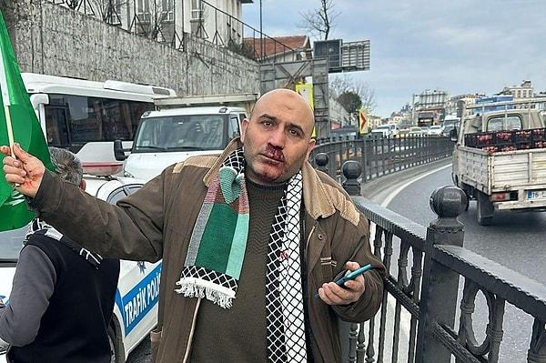 Geçtiğimiz gün İstanbul'da gerçekleşen Filistin'e Destek Yürüyüşü sonrası İsmail Aydemir isimli kişi 'Hilafet bayrağı' açtığı gerekçesiyle yumruklu saldırıya uğramıştı.