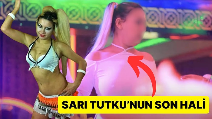 Geri Döndü! Pavyon Dansıyla Dayılara Tarla Sattıran Sarı Tutku'nun Son Halini Görünce Şaşıracaksınız