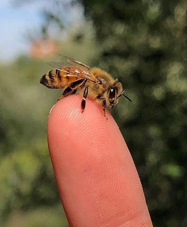 10- "Arı sokmalarına karşı anafilaktik alerjik reaksiyonlarım var, bu yüzden her hafta arılara karşı daha az alerjik olacağım umuduyla seyreltilmiş arı zehri iğneleri oluyordum."