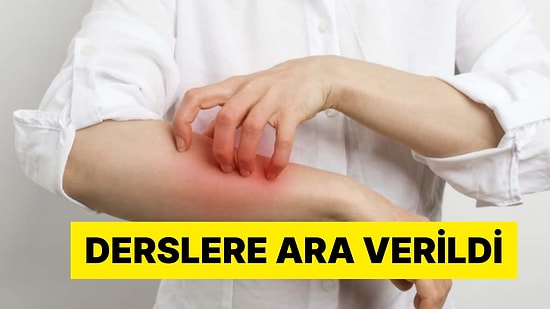 Büyük İddia: İzmir'de Uyuz Salgını Nedeniyle Sınıf Kapatıldı