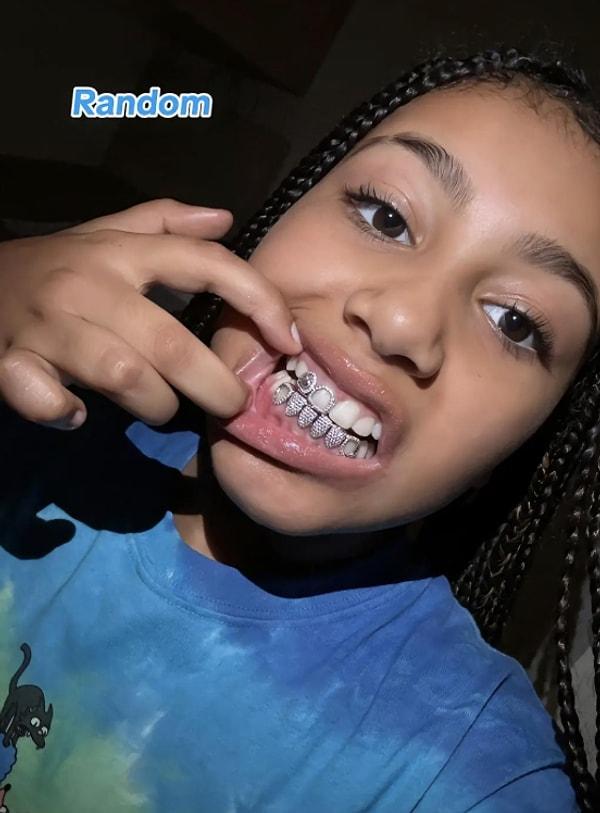 10 yaşındaki North West, babası Kanye 850 bin dolarlık titanyum takma dişlerini sergilerken elmas kaplı dişlerini böyle gösterdi.