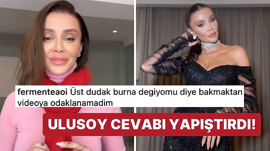 Özge Ulusoy, Dudakları İle İlgili Yorum Yapan Takipçisine Verdiği Cevapla Dikkat Çekti