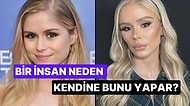 Akılalmaz Estetik Uygulamalarını Paylaşarak Güzellik Standartlarına Lanet Ettiren 15 Kişi
