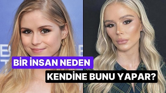 Akılalmaz Estetik Uygulamalarını Paylaşarak Güzellik Standartlarına Lanet Ettiren 15 Kişi