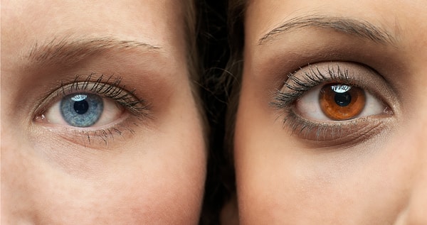 Despite their functional and aesthetic appeal, it is crucial to recognize that eye color-changing surgeries can lead to serious consequences such as vision loss and enduring aesthetic deformities.