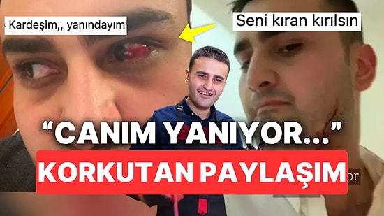 CZN Burak Son Videosunda Kesik ve Yara Dolu Hallerini "Canım Yanıyor" Diye Paylaşarak Herkesi Korkuttu
