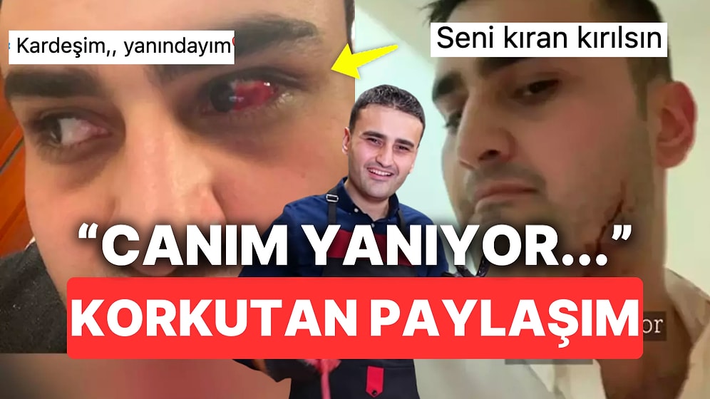 CZN Burak Son Videosunda Kesik ve Yara Dolu Hallerini "Canım Yanıyor" Diye Paylaşarak Herkesi Korkuttu