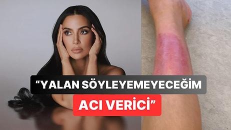 Kim Kardashian Hesabında Bacağında Oluşan Uzun Süreli Yaraları Paylaştı: Takipçileri Şaşkına Döndü
