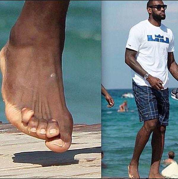 Daha önce sık sık başarılarıyla andığımız LeBron James'in deforme olmuş ayak parmakları çok konuşuldu.