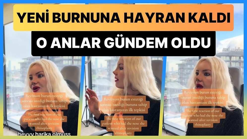 Hasan Can Kaya Görmesin: Revizyon Burun Estetiği Yaptıran Kadın Gündem Oldu