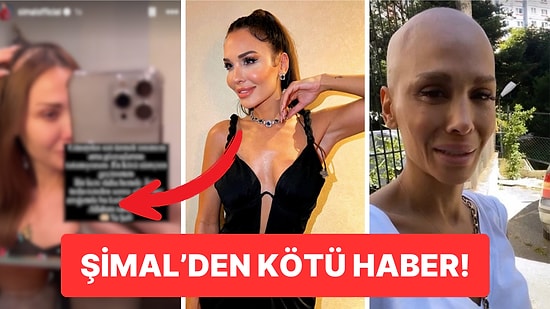 Beyninde Tümör Görülmüştü: Şarkıcı Şimal ‘Gözyaşlarımı Tutamıyorum’ Diyerek Dökülen Saçlarını Paylaştı!