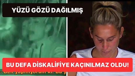 Survivor'da Pınar'la Girdiği Kavga Sonucu Yüzü Yara Bere İçinde Kalan Sema'nın Hali İzleyiciyi Şoka Soktu!