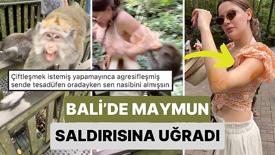 Çıktığı Bali Tatilinde Bir Maymunun Saldırısına Uğrayan Kadın Yaralandı: O Anlar Kamerasına Yansıdı