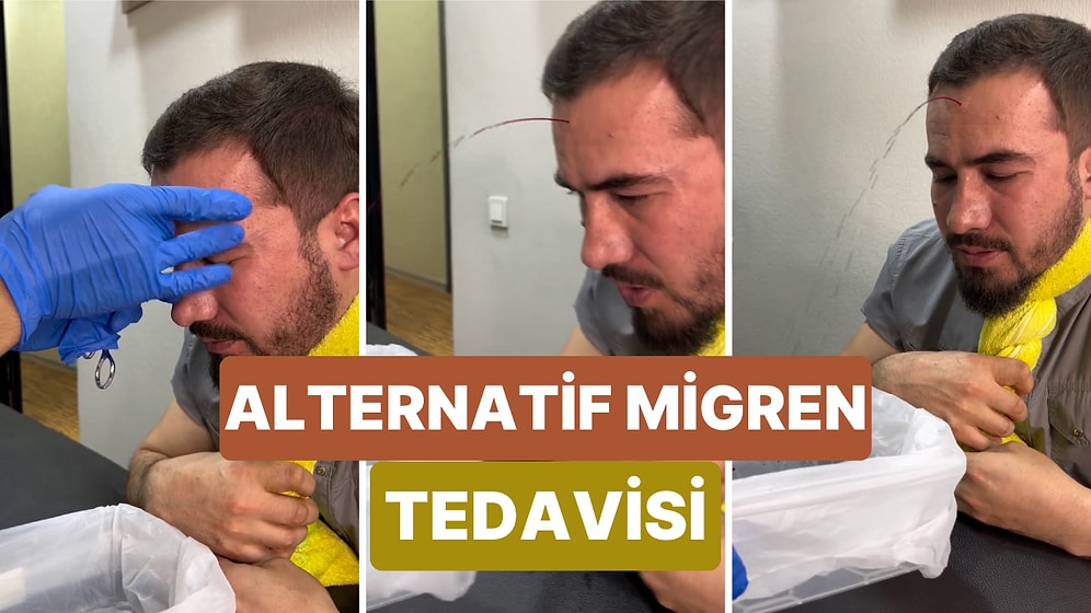 Migren Tedavisi İçin Kullanılan Alternatif Yöntemle Alnı Delinen Hastanın Başından Akan Kan Şaşırttı