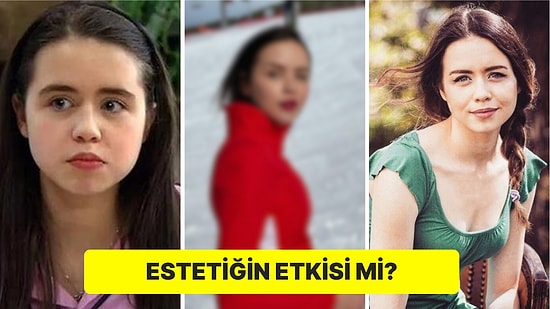 'Alemin Kralı' Dizisiyle Tanıdığımız Oyuncu Yağmur Ün'ün Son Hali Büyüledi