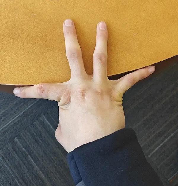 1. Parmakları birbirinin 180° tersini gösterebilen bu kişi gibi: