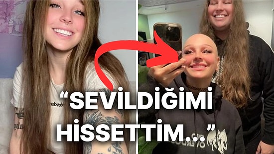 Saçkıran Hastalığına Yakalanan Kız Arkadaşına Kendi Saçlarından Peruk Yaptıran Adamın İlginç Hikayesi
