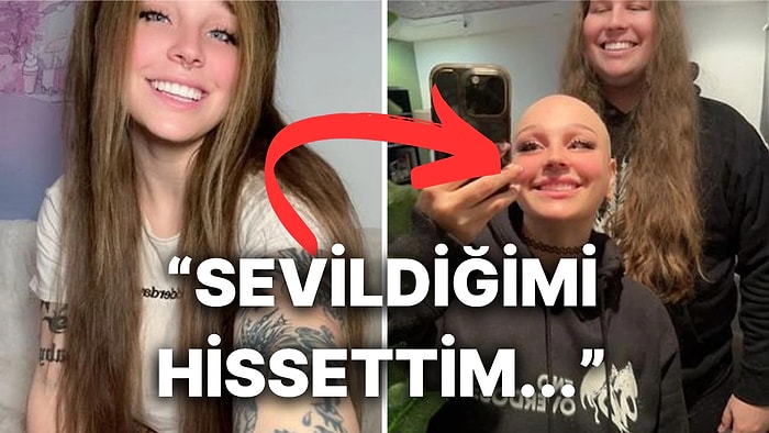Saçkıran Hastalığına Yakalanan Kız Arkadaşına Kendi Saçlarından Peruk Yaptıran Adamın İlginç Hikayesi