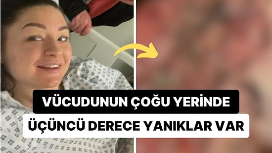 33 Yaşındaki Kadın, Regl Ağrılarını Azaltması İçin Aldığı Sıcak Su Torbasının Kurbanı Oldu