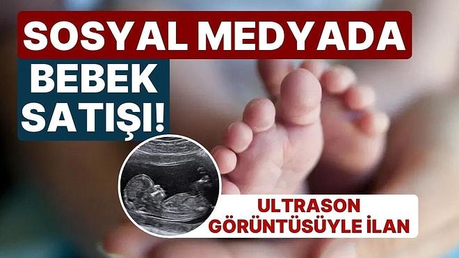 Sosyal Medyada 'Bebek' Satışı! Ultrason Görüntüsüyle İlana Koydu