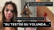 Eski Sevgilisinden Şiddet Gören OnlyFans Fenomeni Merve Taşkın'a Gelen İnsanlık Dışı Yorumlar!