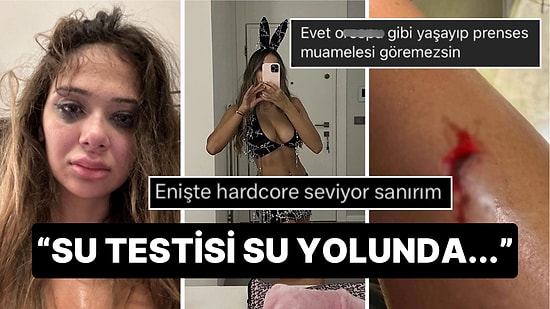 Eski Sevgilisinden Şiddet Gören OnlyFans Fenomeni Merve Taşkın'a Gelen İnsanlık Dışı Yorumlar!