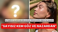 El Birliği İle Nazar Değdirdik! Cam Gibi Cildiyle Nam Salmış Model Hailey Bieber Yüzünün Geldiği Hali Paylaştı