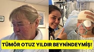Gıda Zehirlenmesi Nedeniyle Hastaneye Kaldırılan Kadının Beyninde Tümör Olduğu Ortaya Çıktı!
