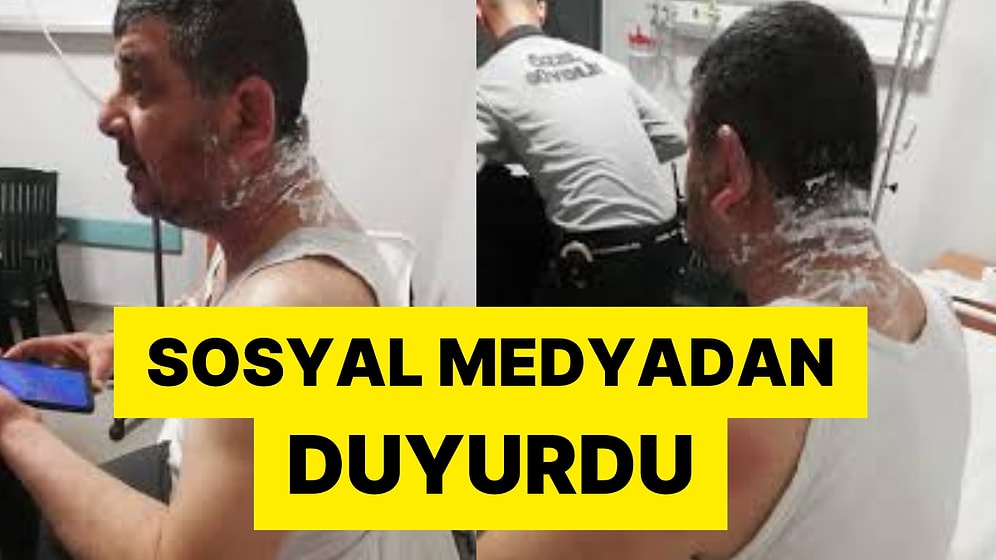 Korkunç Olay: Meclis Üyesi Adayına Asitli Saldırı!