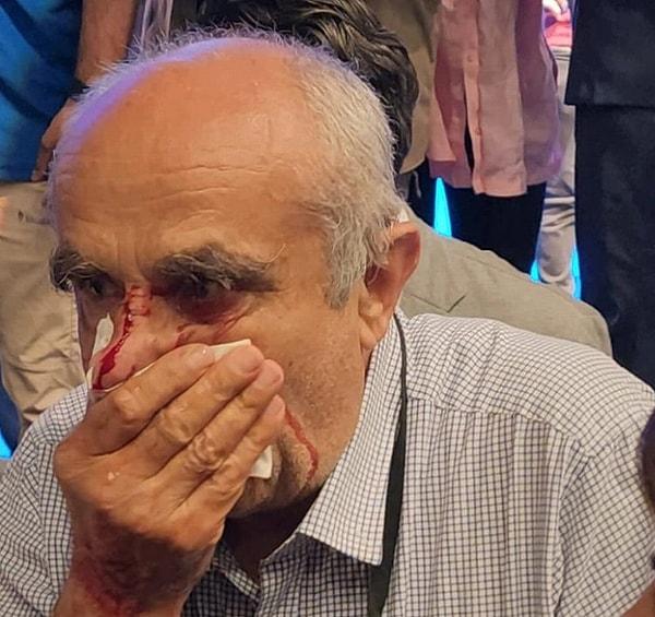 Yıldırım Belediye Başkanı Oktay Yılmaz'ın mazbata törenine gölge düştü. Törende, MHP Meclis Üyesi Alparslan Karaaslan, 76 yaşındaki CHP'li Meclis üyesi Zülfikar Bal'a kafa atarak burnunu kırdı.