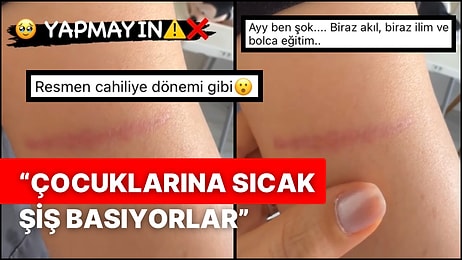 Bir Çocuk Doktoru Ürtiker Sebebiyle Çocuklarına Sıcak Şiş ve Jiletle Müdahale Edenler Olduğunu Anlattı