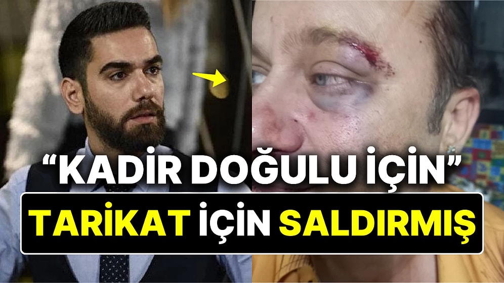Onur Akay Durup Dururken Kendisine Saldıran Kişinin "Kadir Doğulu İçin, Tarikat İçin" Dediğini Söyledi!
