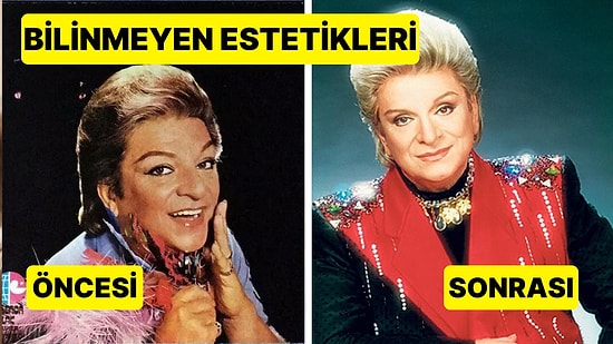Zeki Müren'in Kimsenin Bilmediği Estetik Ameliyatının Ayrıntıları ve Yaşadığı Ölüm Korkusu