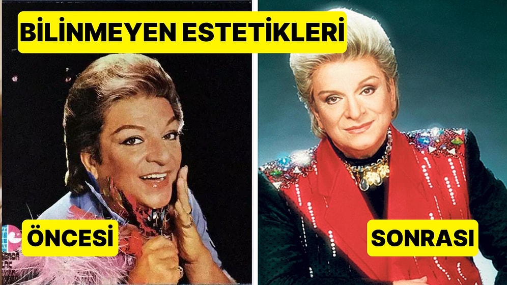 Zeki Müren'in Kimsenin Bilmediği Estetik Ameliyatının Ayrıntıları ve Yaşadığı Ölüm Korkusu