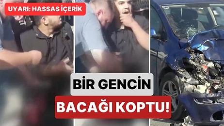 İstanbul'da Feci Kaza: Karşıya Geçerken Araçların Arasına Sıkışan Bir Gencin Bacağı Koptu