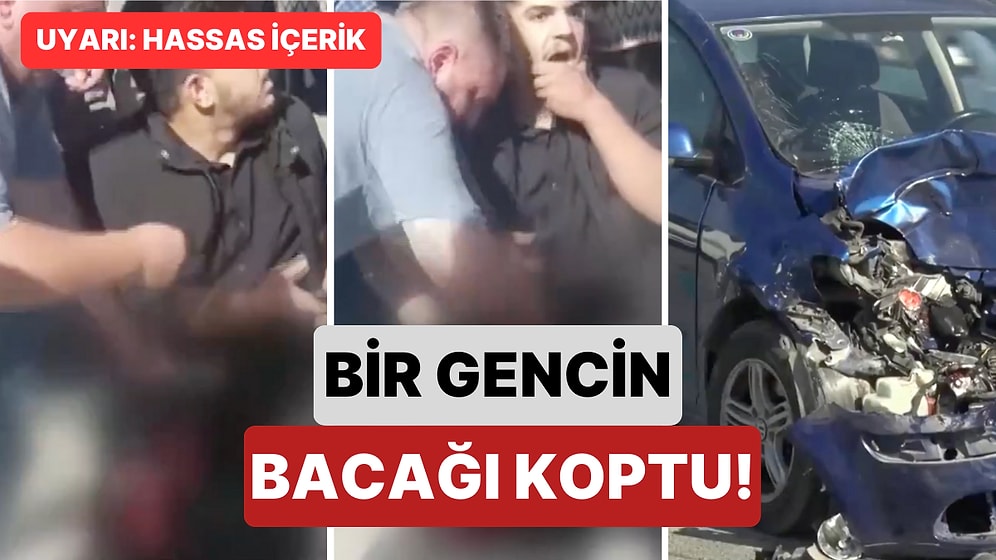 İstanbul'da Feci Kaza: Karşıya Geçerken Araçların Arasına Sıkışan Bir Gencin Bacağı Koptu