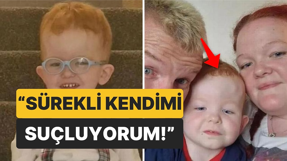 Yeni Doğan Çocuğunun Nadir Görülen Bir Kafatası Hastalığına Sahip Olduğunu Öğrenen Annenin Trajik Hikayesi