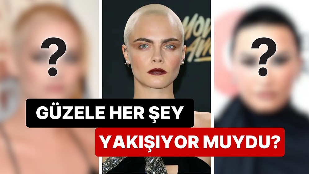 Güzele Her Şey Yakışıyor muydu? Saçlarını Kazıtmadan Önce ve Sonra Etkileyici Görünmeyi Başaran 10 Ünlü İsim