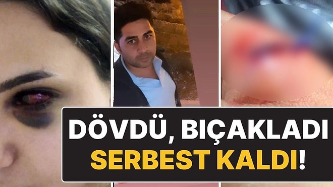 Eşini Tehdit Eden, Döven Sonra da Bıçaklayan ‘Adam’ Serbest Bırakıldı!