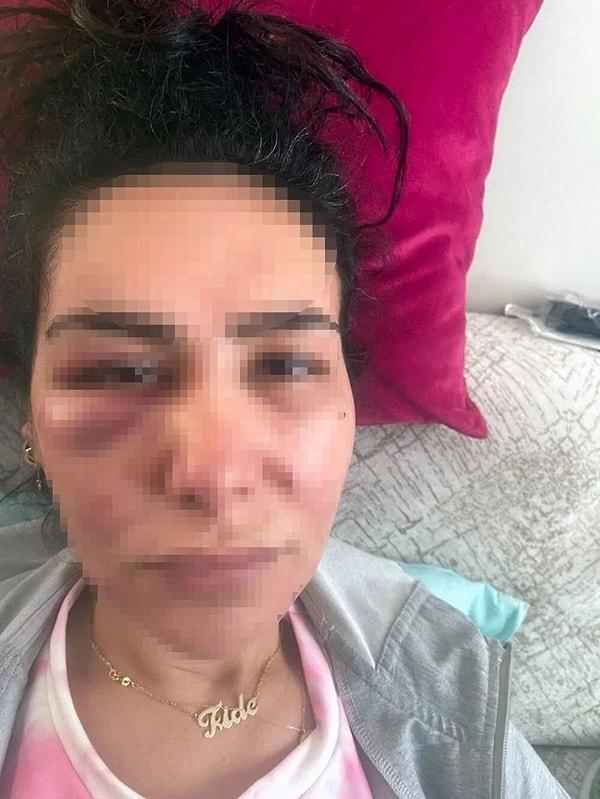 Gökhan Kızılyer isimli şahıs son olarak, 22 Mayıs 2022'de yan daireden balkonuna geçip Fide U.’nun evine zorla girdi ve kadına cinsel saldırıda bulunup darp etti.