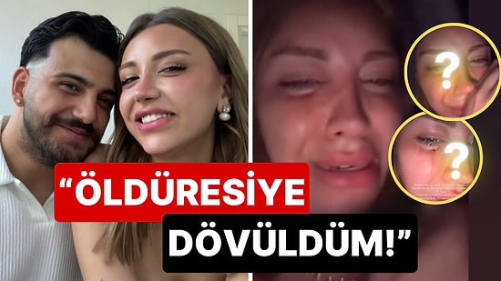 Mika Raun ve Yüzünü Yeni Gösterdiği Erkek Arkadaşı Saldırıya Uğradı: "Öldüresiye Dövüldüm"