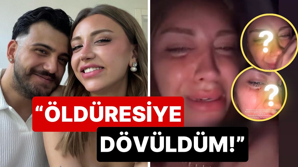 Mika Raun ve Yüzünü Yeni Gösterdiği Erkek Arkadaşı Saldırıya Uğradı: "Öldüresiye Dövüldüm"