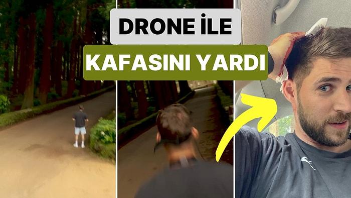 Teknoloji Bir Kere Daha Galip Geldi: Bir Genç Drone ile Havalı Bir Video Çekmek İsterken Kendi Kafasını Yardı