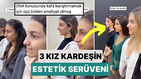 Bir Doktor 3 Kız Kardeşin Aynı Anda Yaptırdığı Aynı Estetik Operasyonla Yaşadığı Değişimi Paylaştı