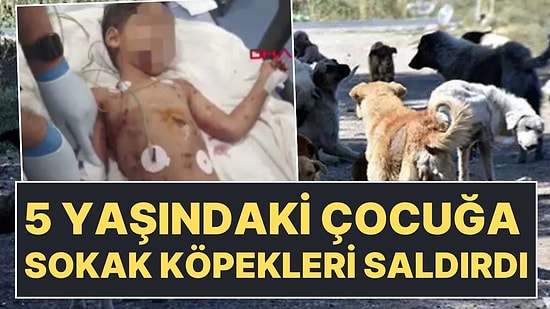 Adana'da Sokak Köpeklerinin Saldırısına Uğrayan 5 Yaşındaki Çocuk Yoğun Bakımda!