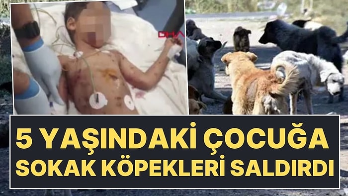 Adana'da Sokak Köpeklerinin Saldırısına Uğrayan 5 Yaşındaki Çocuk Yoğun Bakımda!